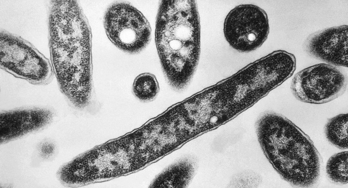 The South Bronx Legionnaires' cluster turns deadly again